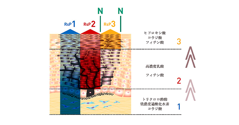 リバースピール
